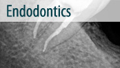 endodoncija