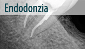 endodoncija