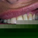 Title #30