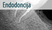 endodoncija